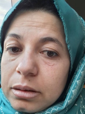 Lutter, fuir, survivre... la résistance de Zarifa, militante afghane